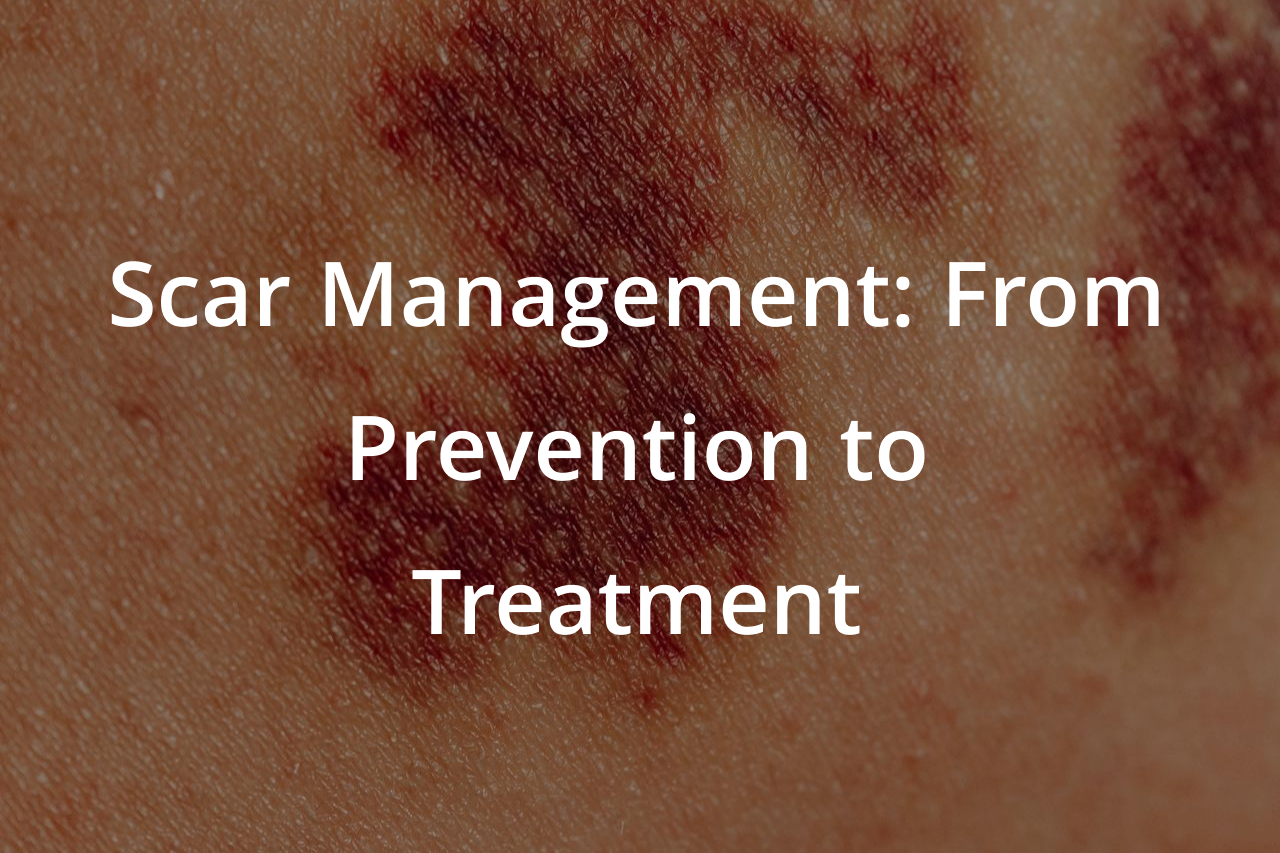 Scar Management: From Prevention to Treatment